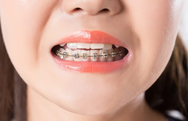 Why Is Early Orthodontic Intervention Important | Perspective Dental | Ashley Smitherman
