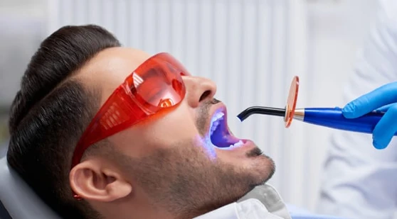 Male patient at Perspective Dentistry in Austin, TX has a tooth-colored filling placed and cured with blue light.